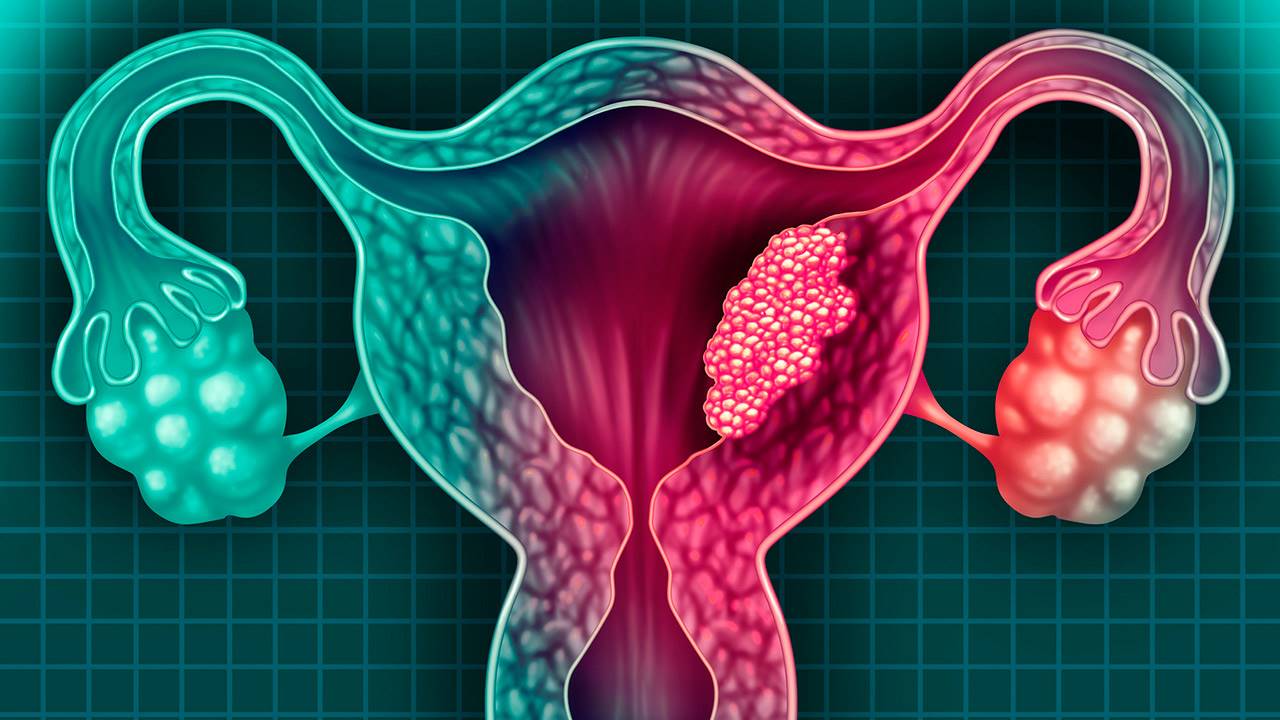 La SAV lleva a las escuelas el mensaje: el cáncer de cuello uterino es prevenible