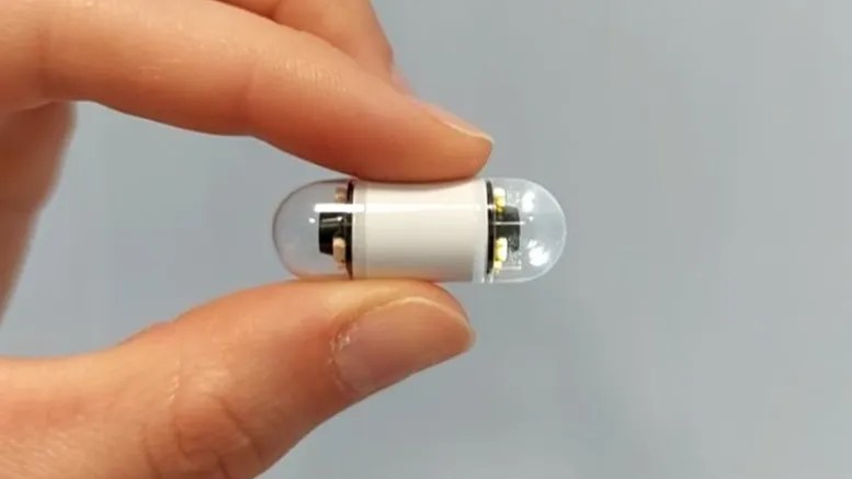 Videocápsula endoscópica facilita el diagnóstico gastrointestinal